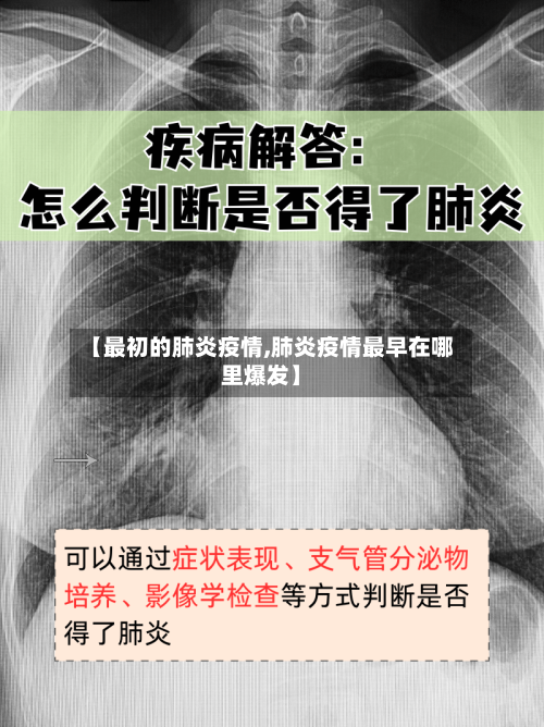 【最初的肺炎疫情,肺炎疫情最早在哪里爆发】-第1张图片